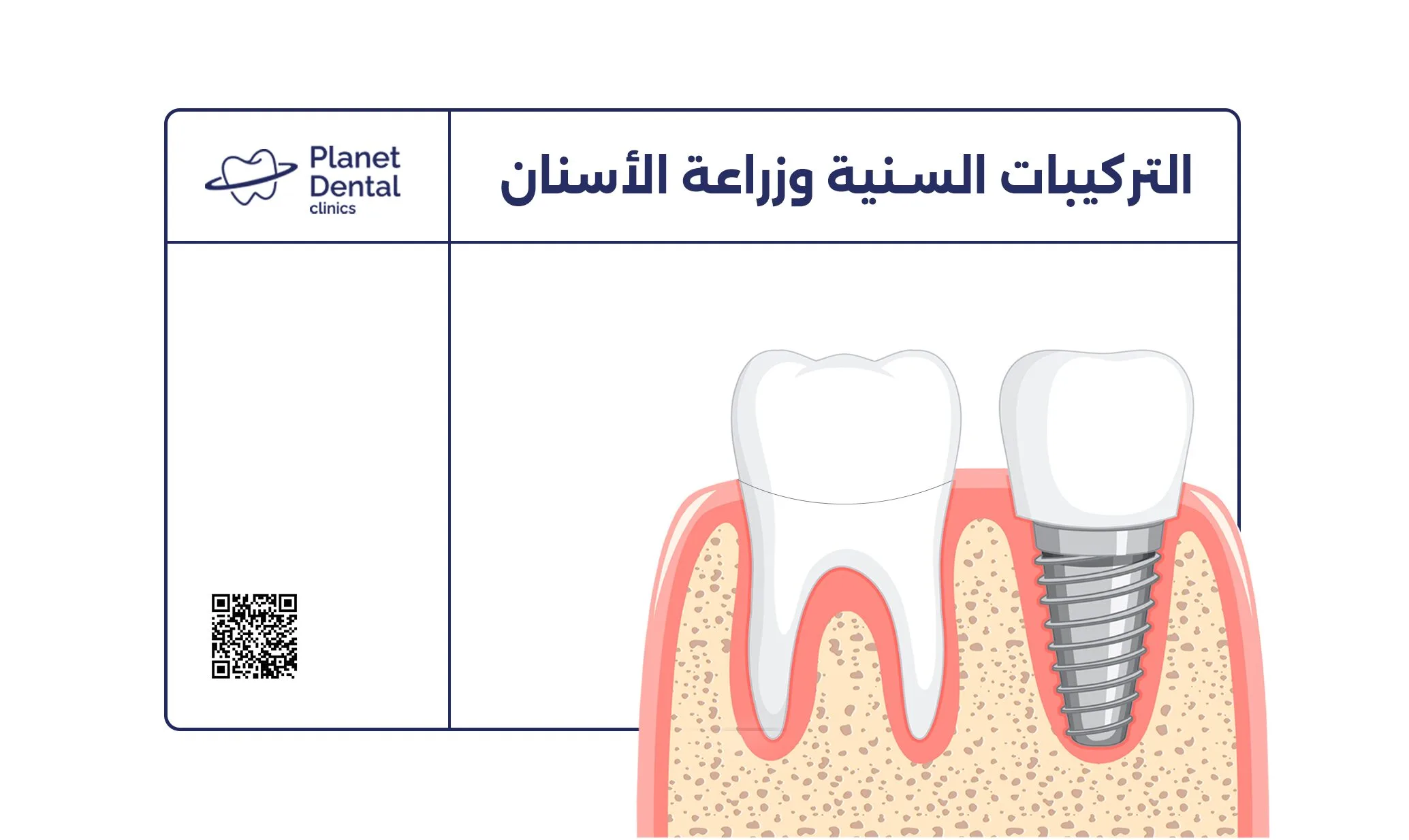 مقارنة بين التركيبات والزراعة