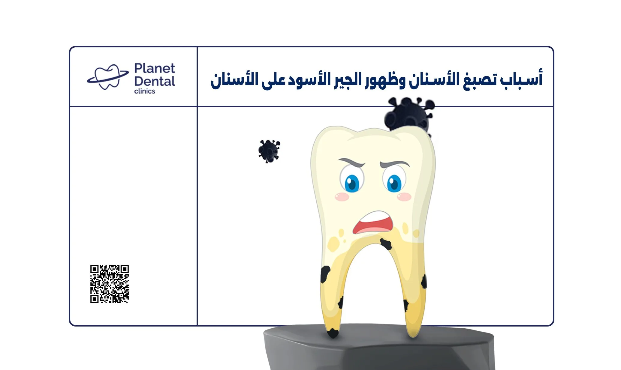 أسباب تصبغ الأسنان وظهور الجير الأسود على الأسنان